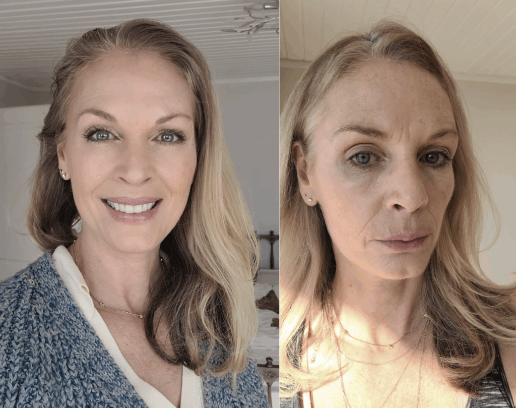 Marion B. : "Après 4 semaines de Collagen Plus, mes rides du visage se sont visiblement estompées."